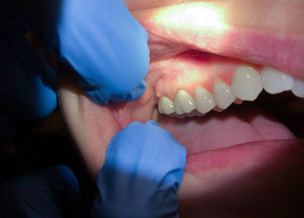 Best Weekend Emergency Dentist in Brownlee Park, MI
