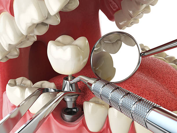Best Broken or Cracked Tooth Emergency Dentist in Brownlee Park, MI